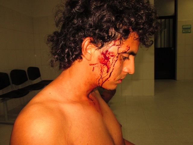 Deyder Hernández muestra los golpes que recibió. Foto: Alberto Buitre